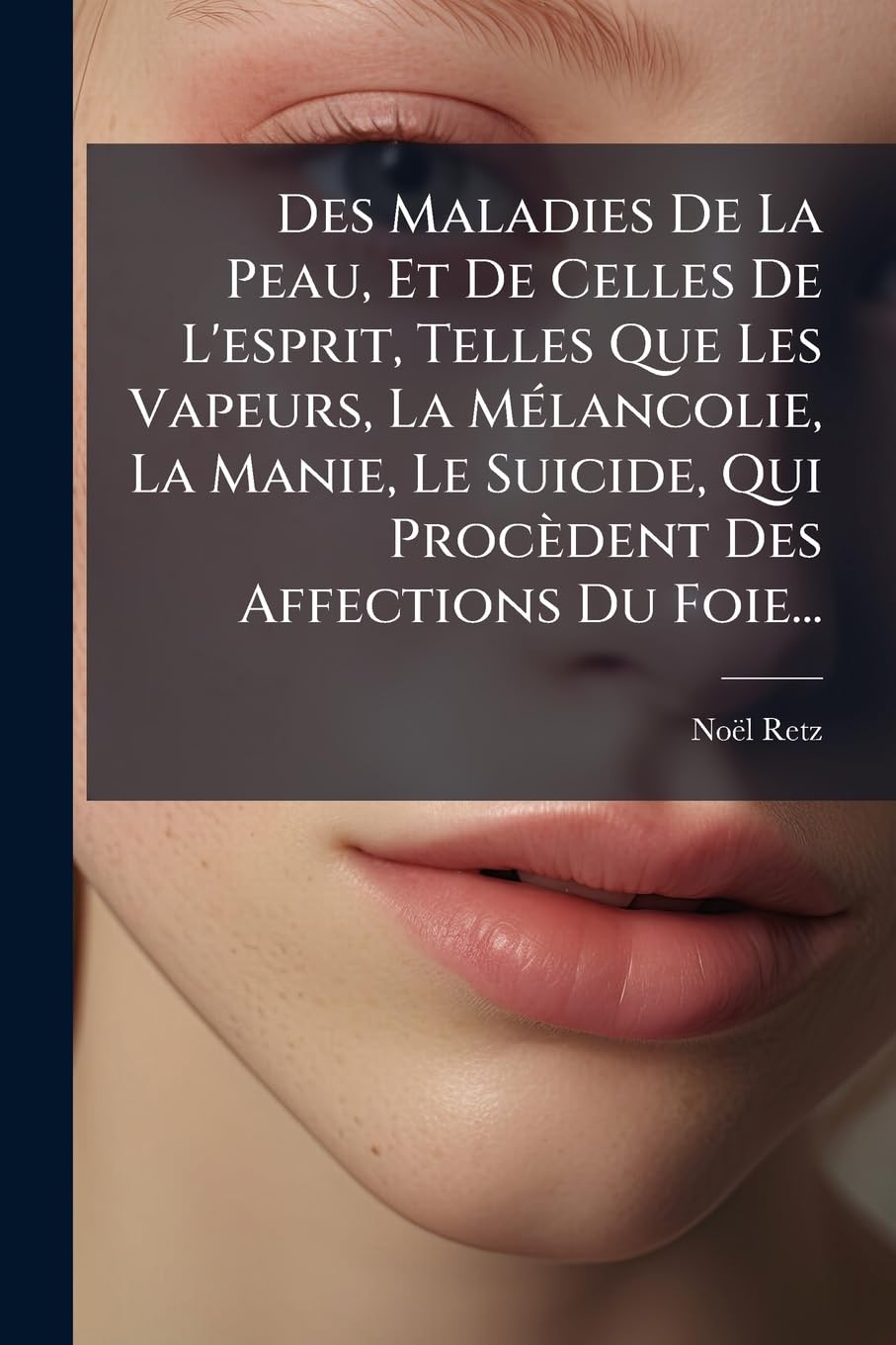 Des Maladies de La Peau, Et de Celles de L'Esprit, Telles Que Les Vapeurs, La M Lancolie, La Manie, Le Suicide, Qui Proc Dent Des Affections Du Foie.. Politics & History