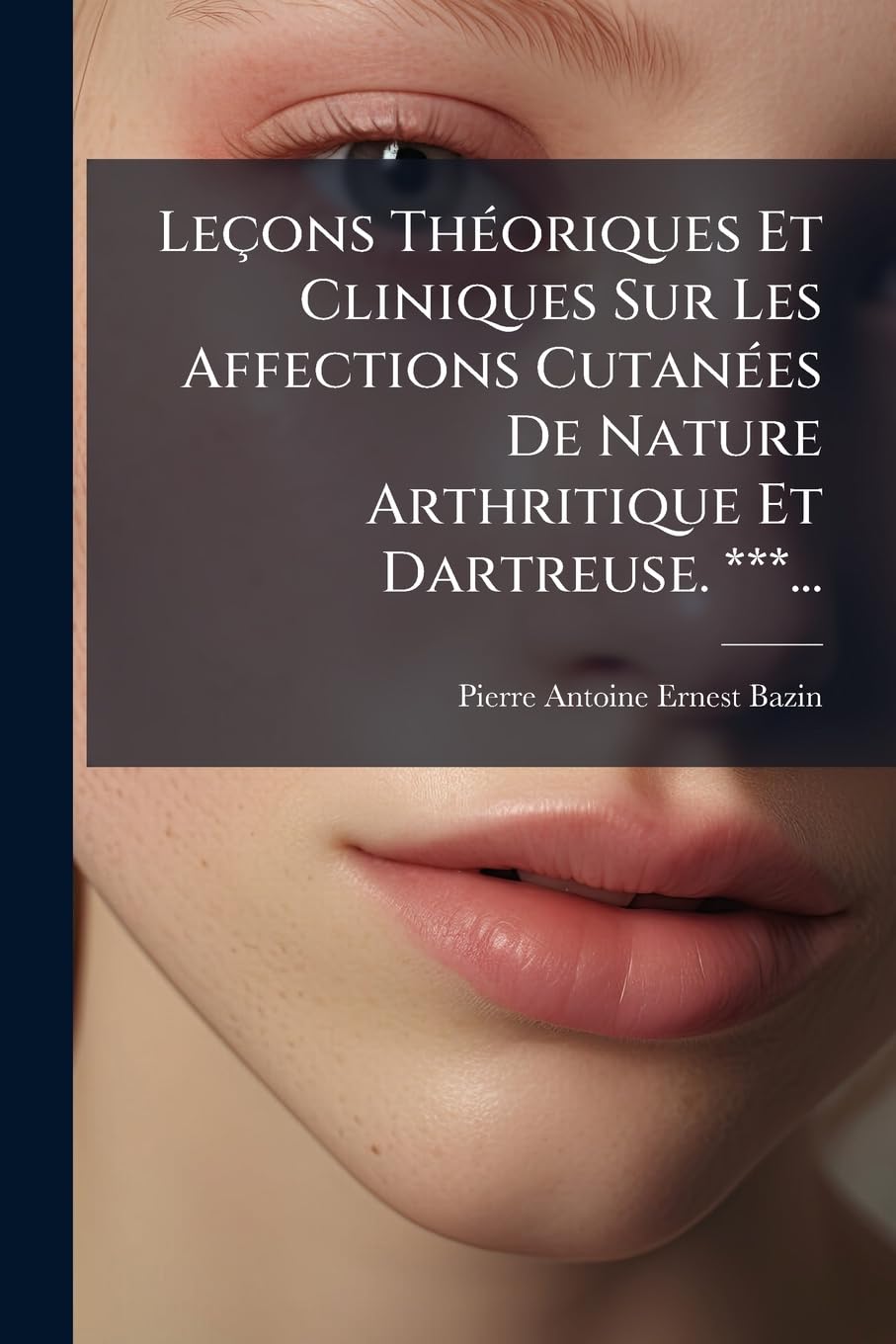 Lecons Theoriques Et Cliniques Sur Les Affections Cutanees de Nature Arthritique Et Dartreuse. ***... book