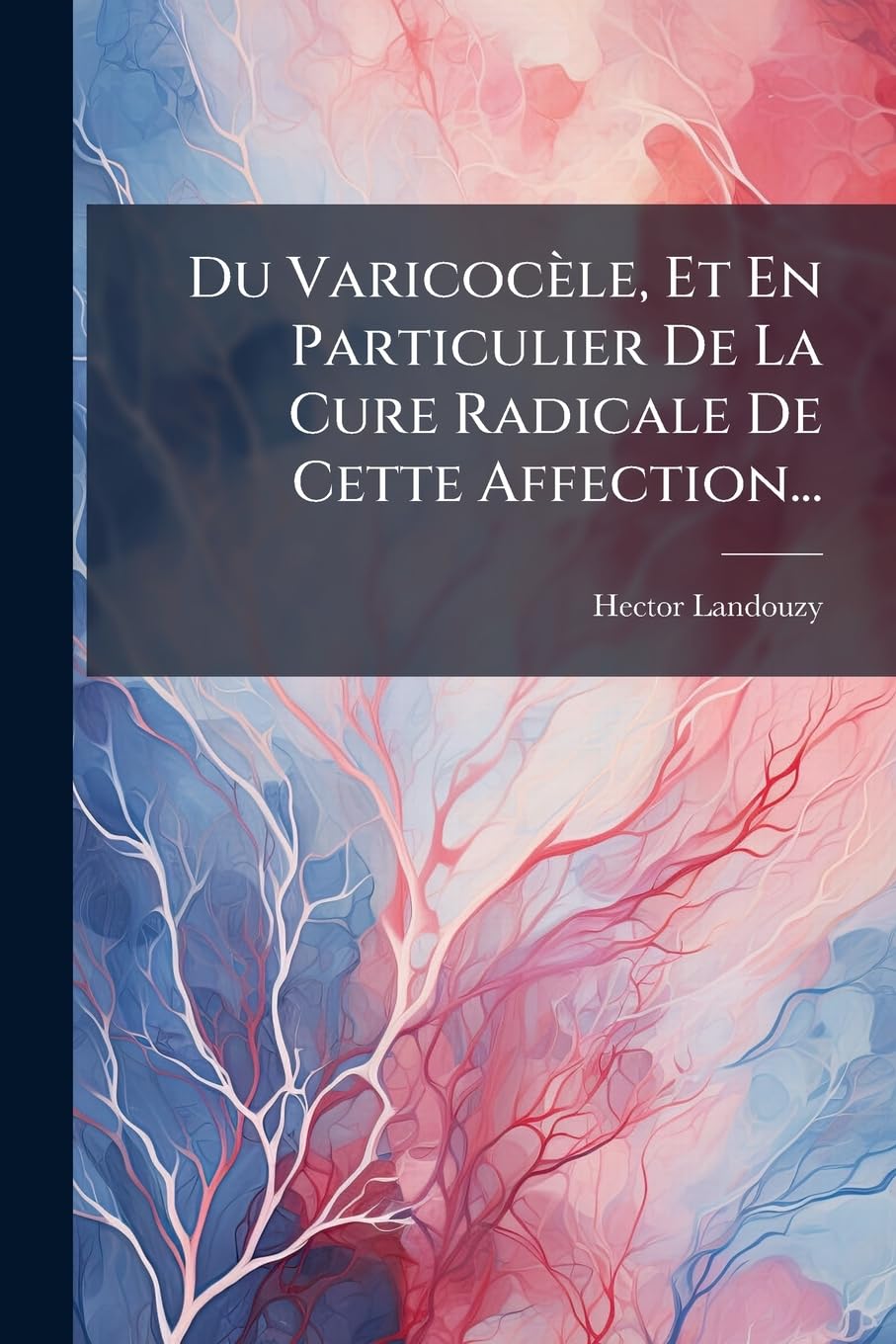 Du Varicocèle, Et En Particulier De La Cure Radicale De Cette Affection... book