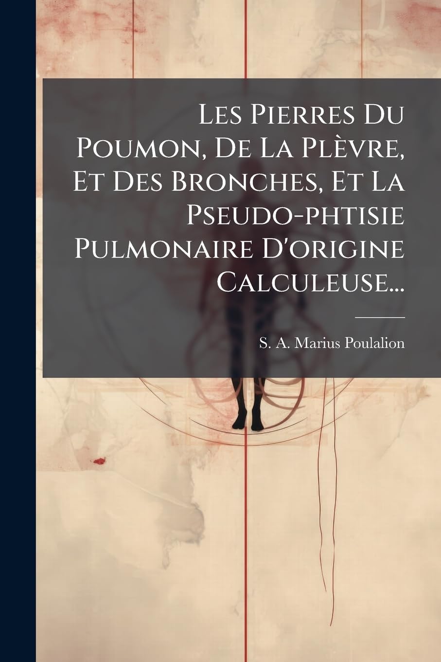 Les Pierres Du Poumon, de la Plèvre, Et Des Bronches, Et La Pseudo-Phtisie Pulmonaire d'Origine Calculeuse... book