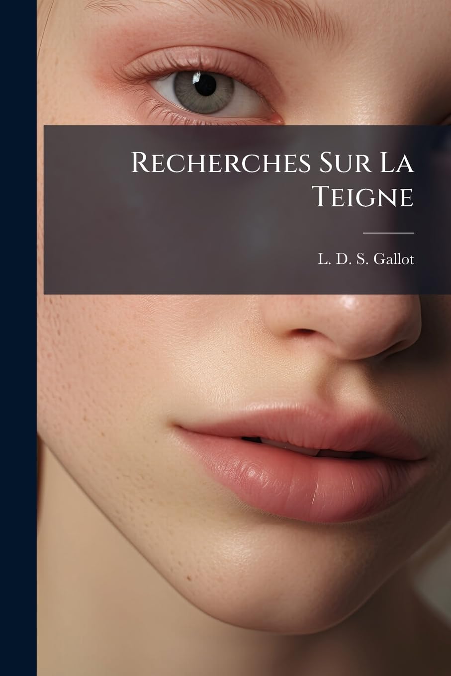Recherches Sur La Teigne: Suivies Des Moyens Curatifs... book
