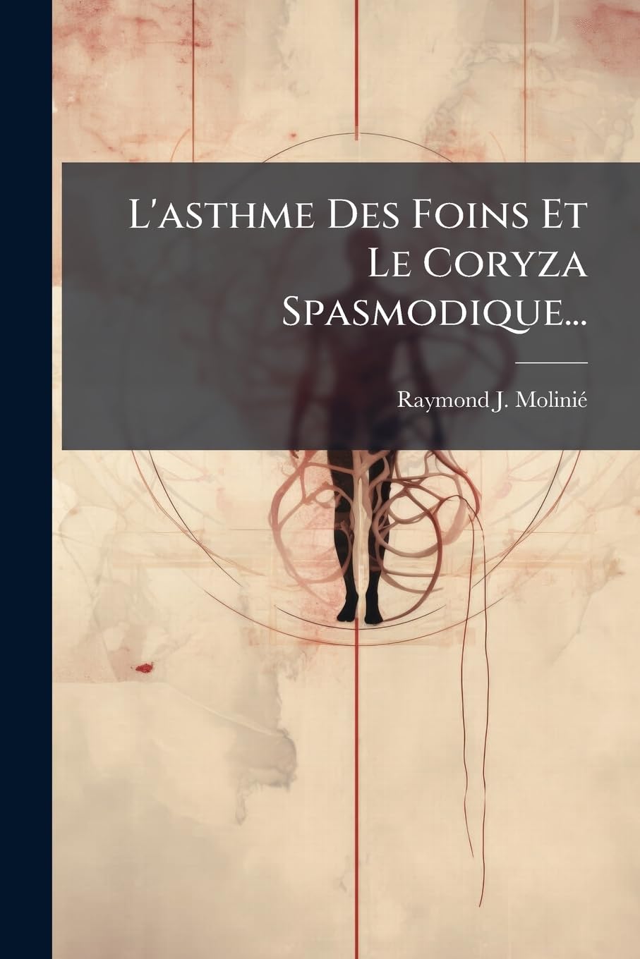 L'Asthme Des Foins Et Le Coryza Spasmodique... book