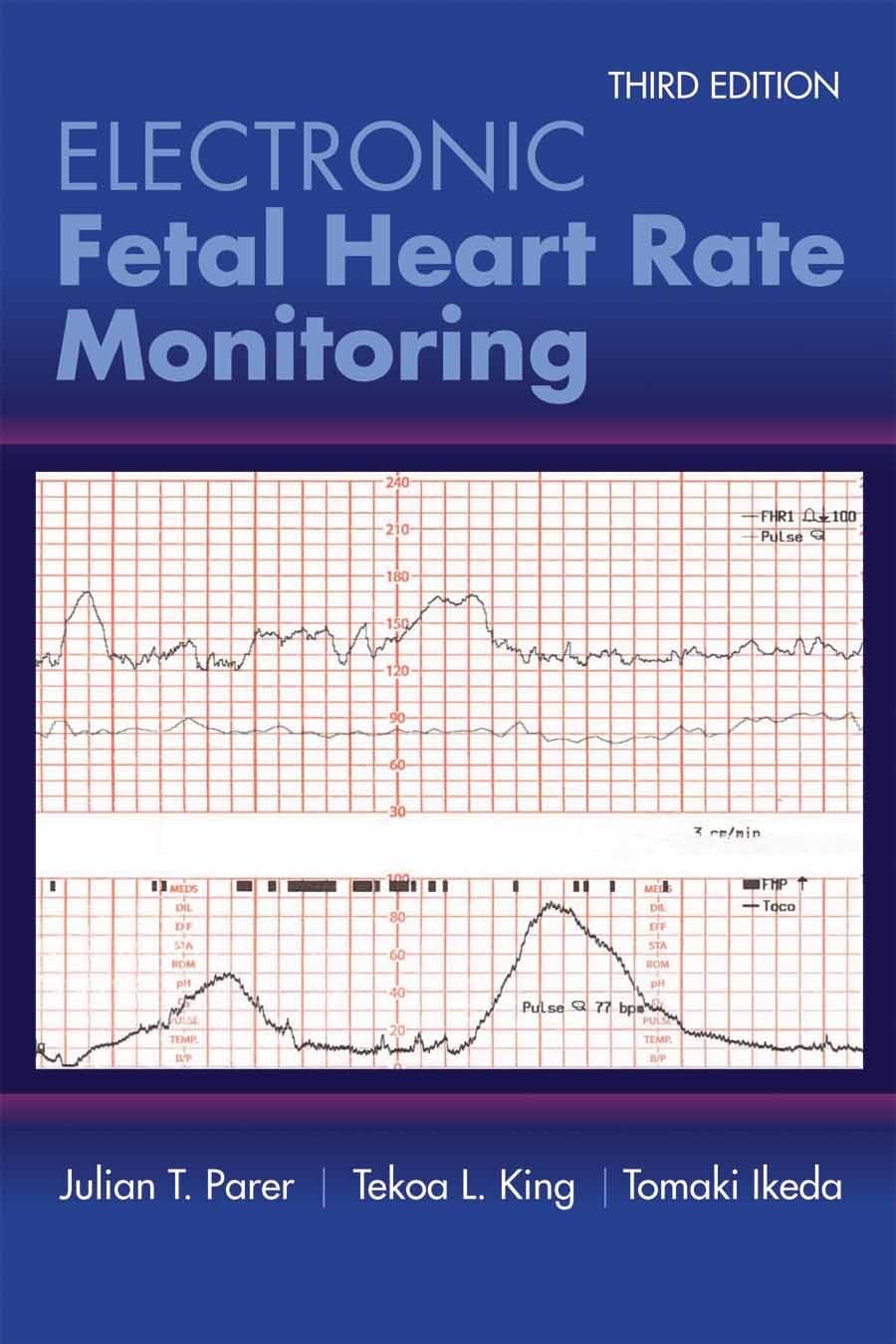 Electronic Fetal Heart Rate Monitoring: The 5-tier System Medicine