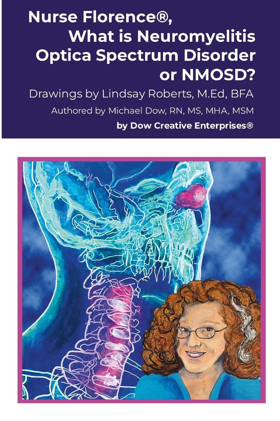 Nurse Florence®, What is Neuromyelitis Optica Spectrum Disorder or NMOSD? Medicine
