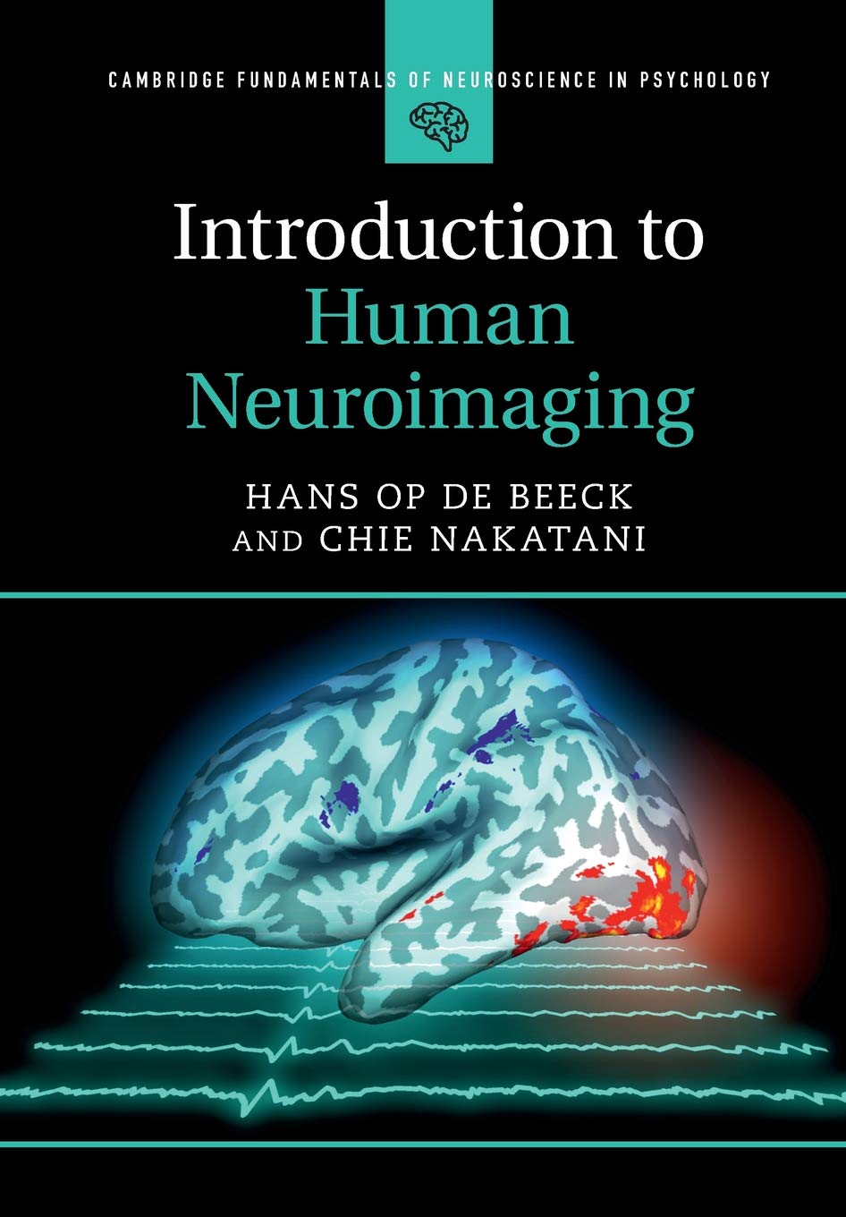 Introduction to Human Neuroimaging (Cambridge Fundamentals of Neuroscience in Psychology) Medicine