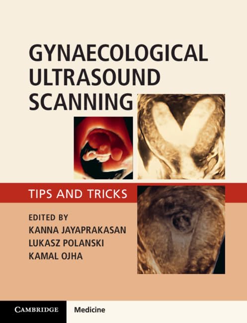 Gynaecological Ultrasound Scanning Medicine