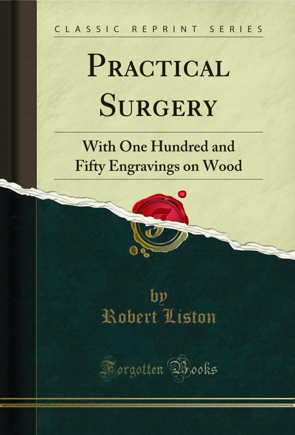 Practical Surgery: With One Hundred and Fifty Engravings on Wood (Classic Reprint) Medicine