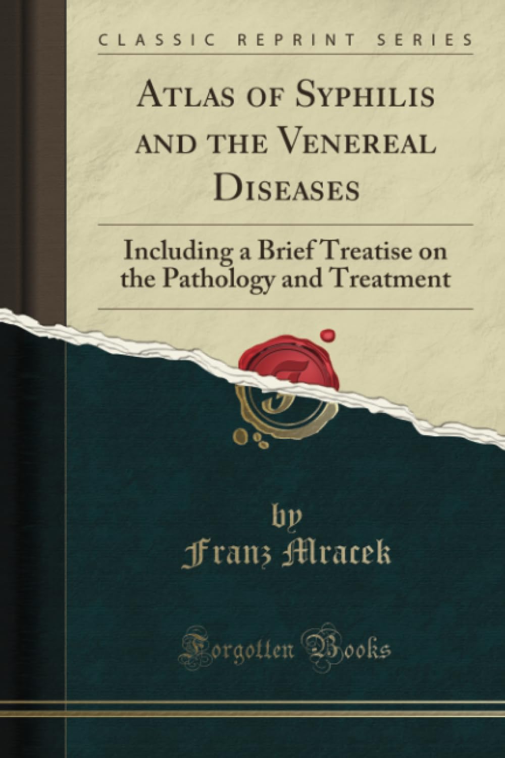 Atlas of Syphilis and the Venereal Diseases (Classic Reprint): Including a Brief Treatise on the Pathology and Treatment: Including a Brief Treatise on the Pathology and Treatment (Classic Reprint) Medicine