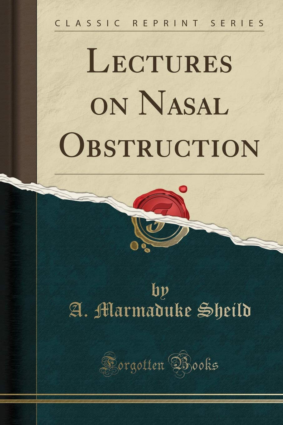 Lectures on Nasal Obstruction (Classic Reprint) Medicine