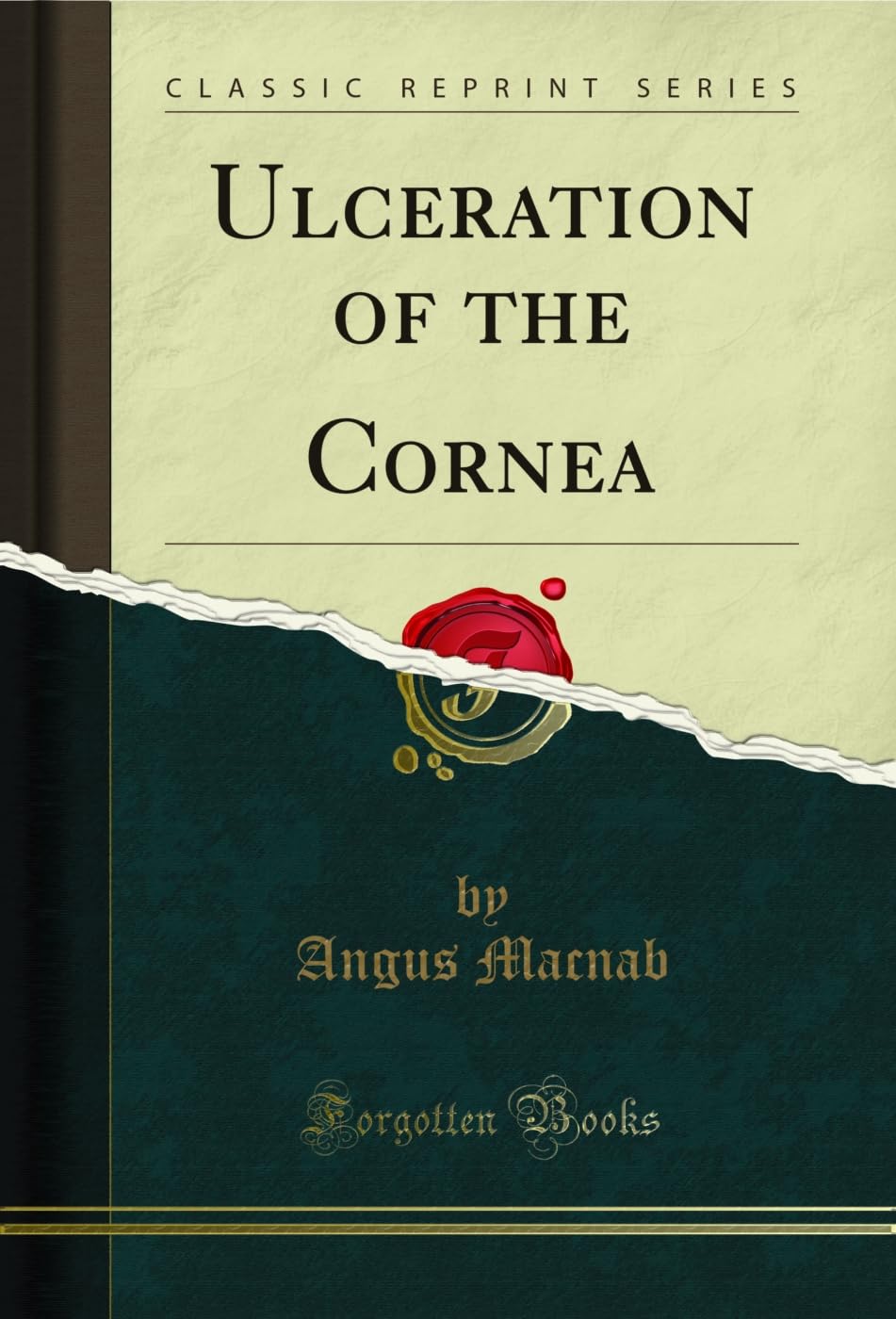 Ulceration of the Cornea (Classic Reprint) Medicine