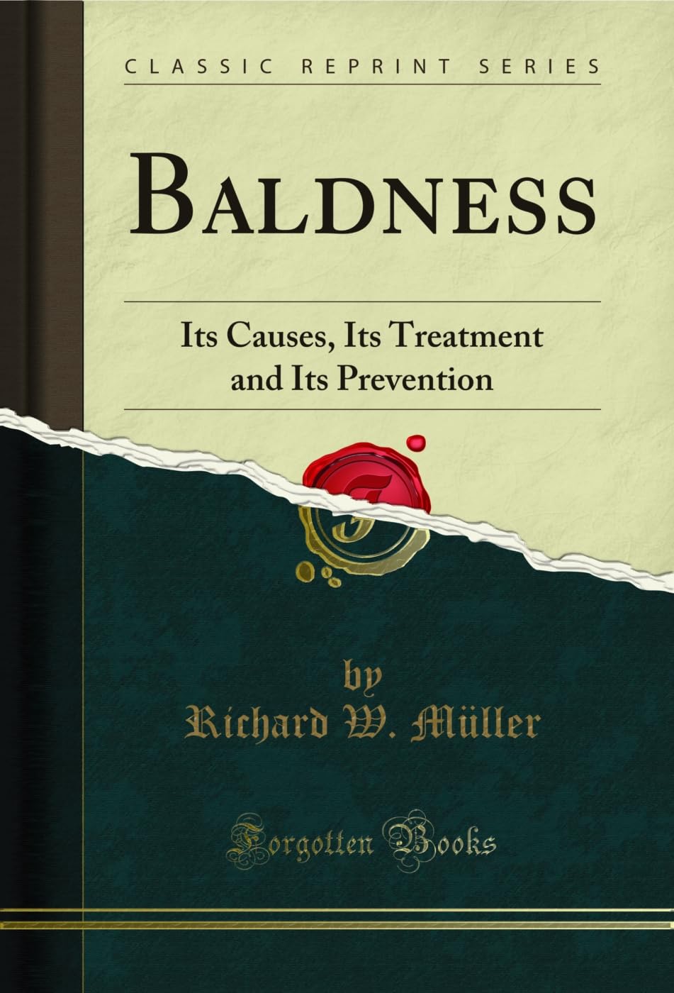 Baldness: Its Causes, Its Treatment and Its Prevention (Classic Reprint) Medicine