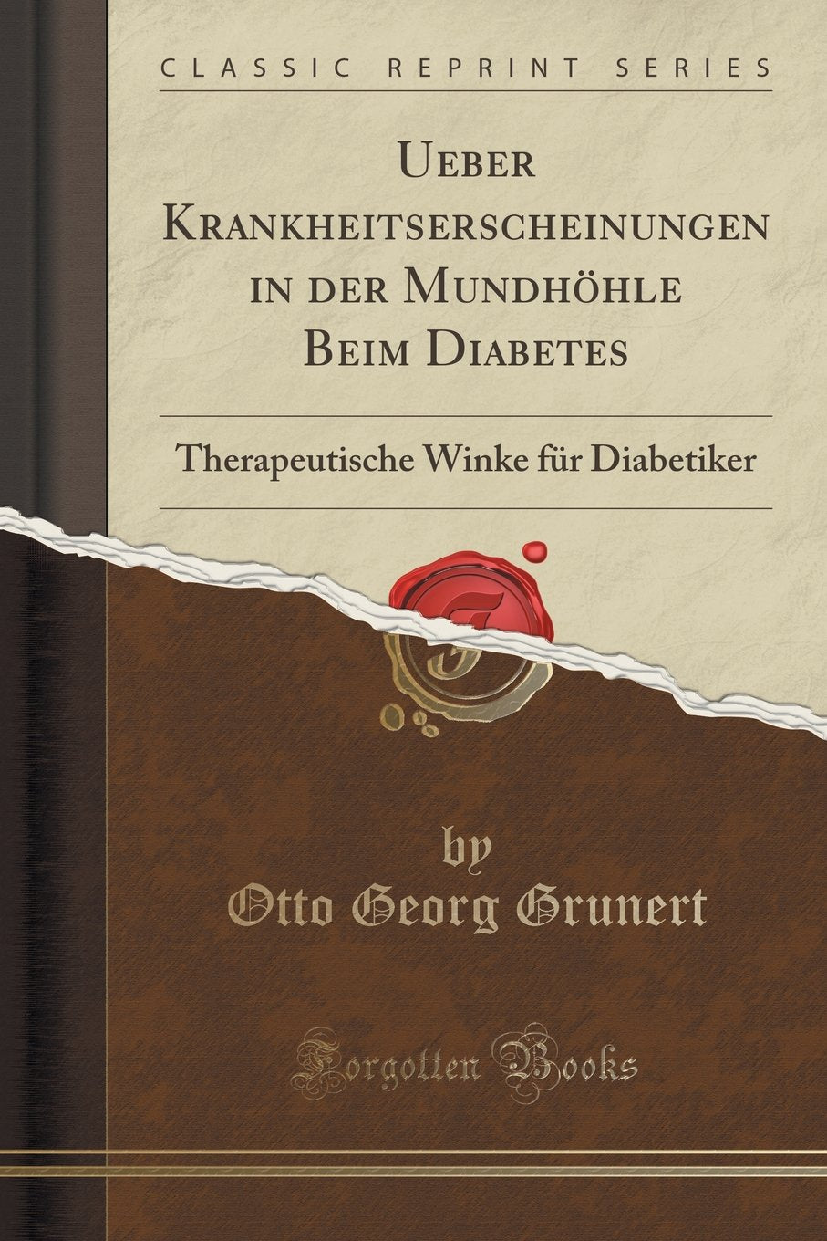 Ueber Krankheitserscheinungen in der Mundhöhle Beim Diabetes: Therapeutische Winke für Diabetiker (Classic Reprint) Health, Nutrition & Fitness