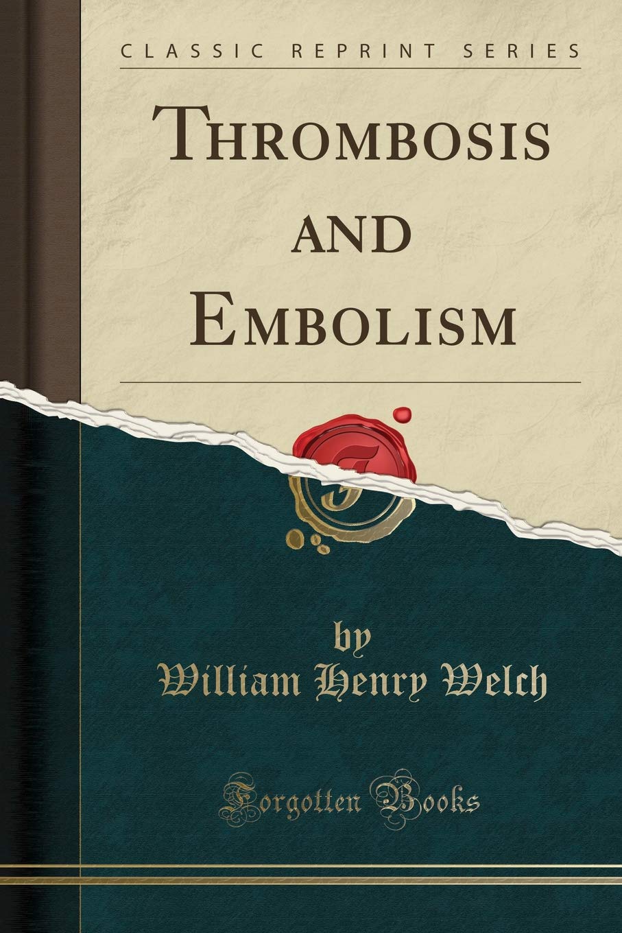 Thrombosis and Embolism (Classic Reprint) Medicine
