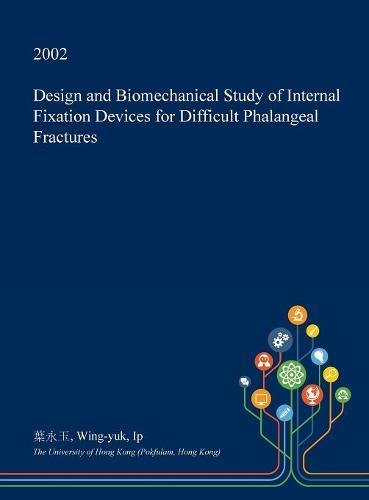 Design and Biomechanical Study of Internal Fixation Devices for Difficult Phalangeal Fractures Medicine