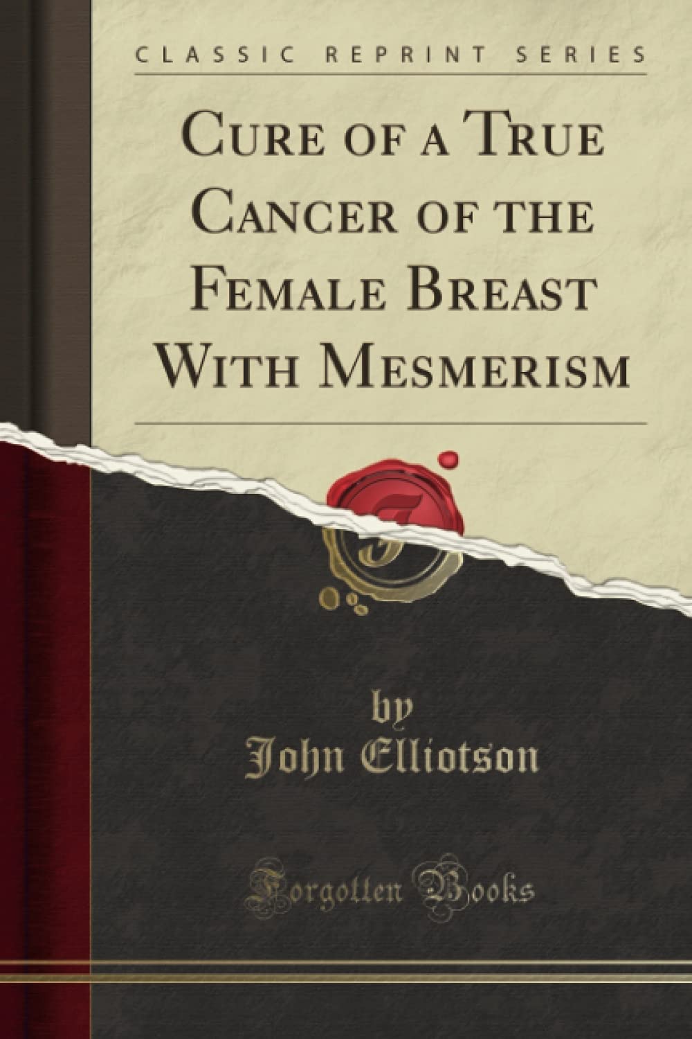 Cure of a True Cancer of the Female Breast With Mesmerism (Classic Reprint) Politics & History