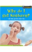 Why Do I Get Sunburn?: And Other Questions About Skin (Body Matters) Non-fiction