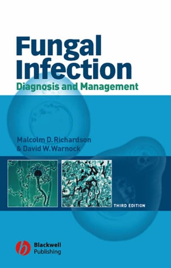 Fungal Infection 3e: Diagnosis and Management Medicine
