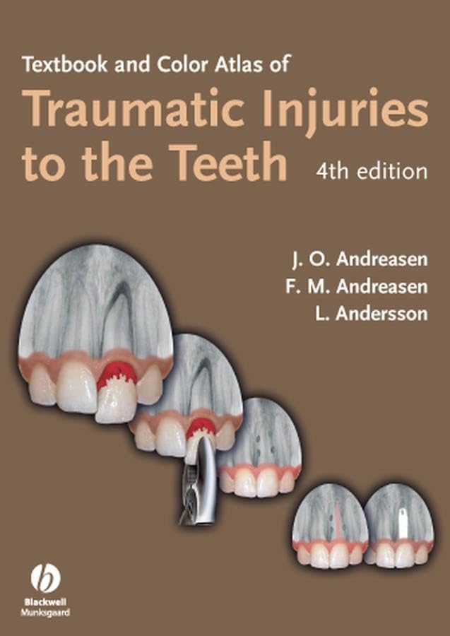 Textbook And Color Atlas Of Traumatic Injuries To The Teeth book