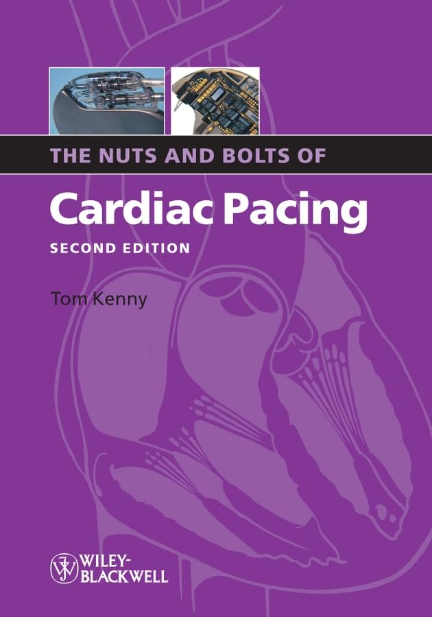 The Nuts And Bolts Of Cardiac Pacing (Nuts and Bolts S.) Medicine