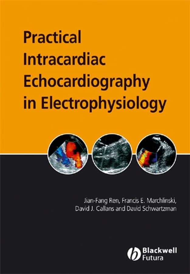 Practical Intracardiac Echocardiography in Electrophysiology Medicine