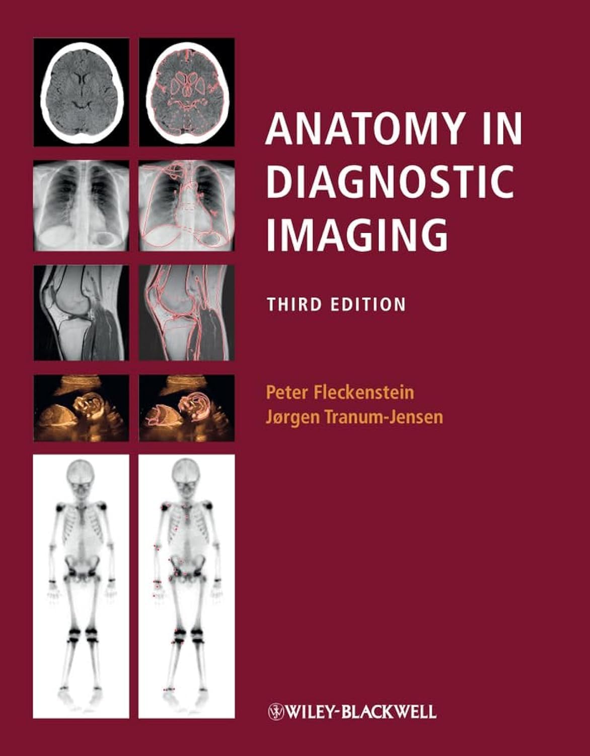 Anatomy in Diagnostic Imaging Medicine