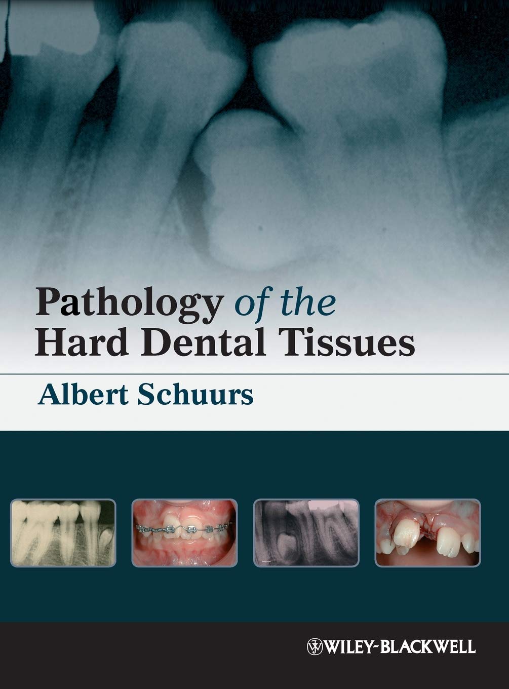 Pathology of the Hard Dental T Medicine