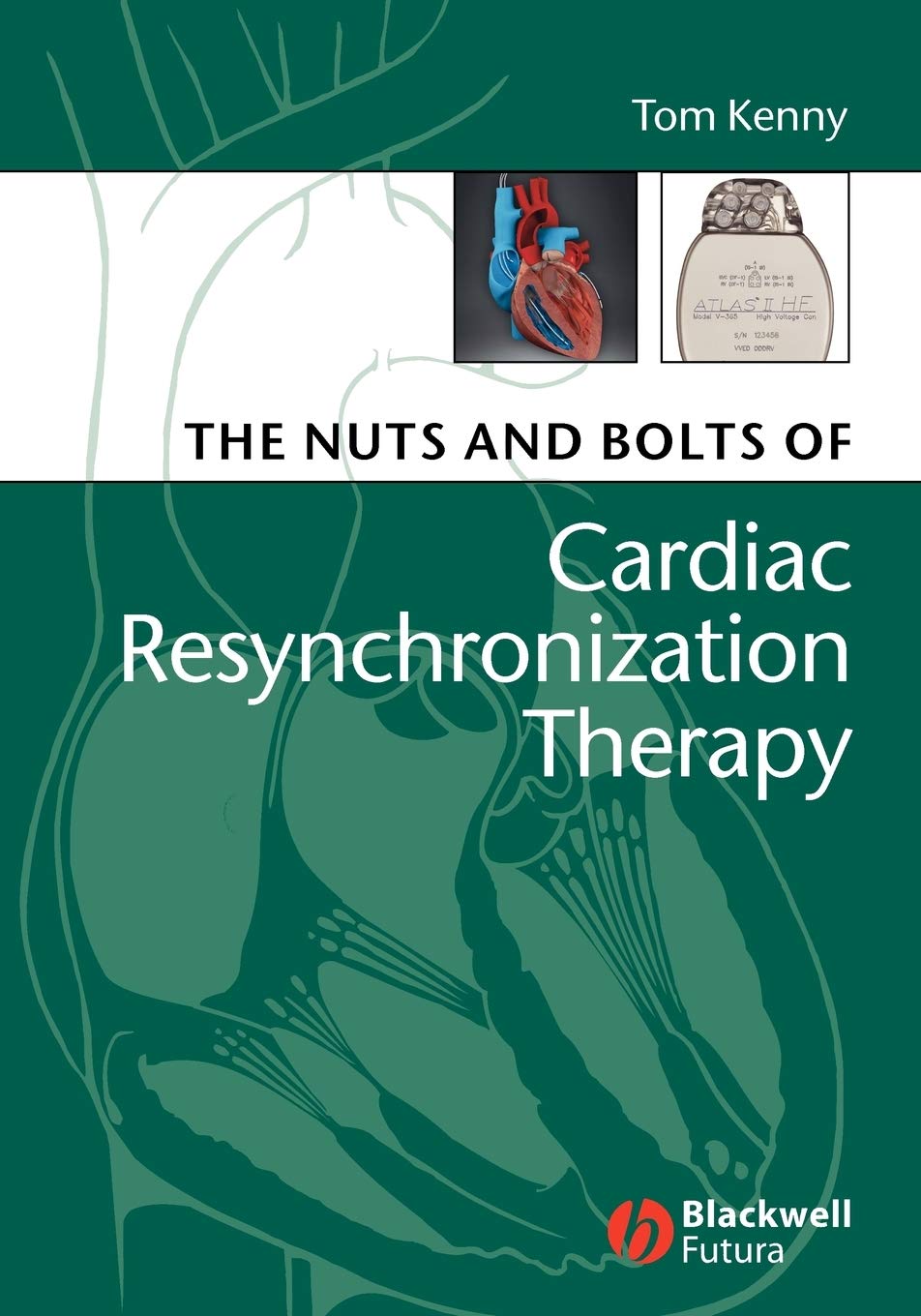 The Nuts and Bolts of Cardiac Resynchronization Therapy (Nuts and Bolts Series (Replaced by 5113), Band 2) Medicine
