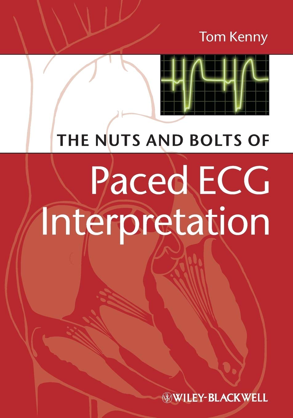 The Nuts and Bolts of Paced ECG Interpretation (Nuts and Bolts Series (Replaced by 5113)) Medicine