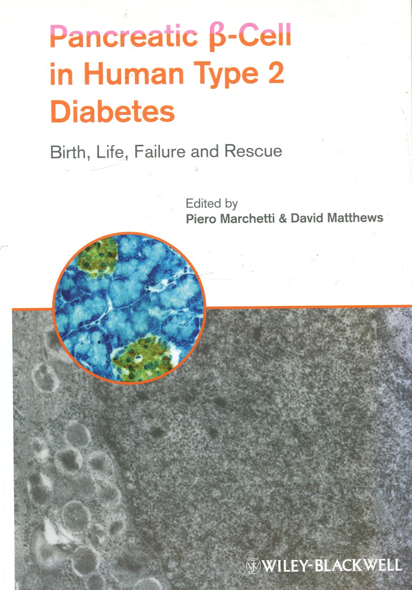 Pancreatic B-Cell in Human Type 2 Diabetes (Pancreatic B-Cell in Human Type 2 Diabetes Birth Books
