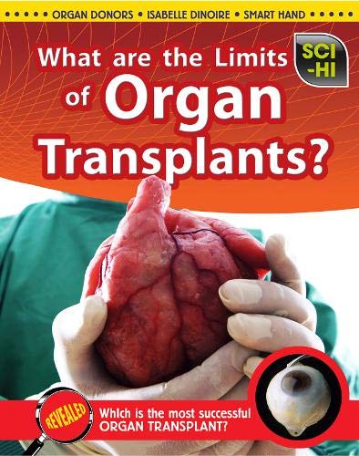 What Are the Limits of Organ Transplantation? (Science Issues) Non-fiction