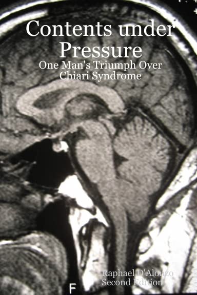 Contents Under Pressure: One Man's Triumph Over Chiari Syndrome Business & Technology