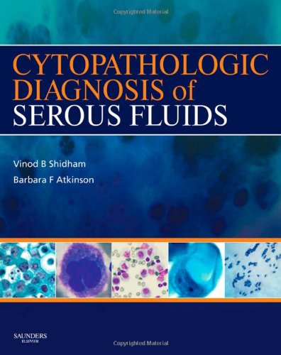 Cytopathologic Diagnosis of Serous Fluids Medicine