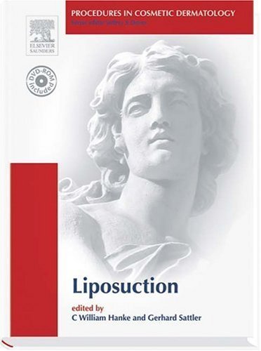Liposuction (Procedures in Cosmetic Dermatology): Procedures in Cosmetic Dermatology Series Medicine
