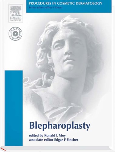 Blepharoplasty. Textbook with DVD (Procedures in Cosmetic Dermatology) Medicine