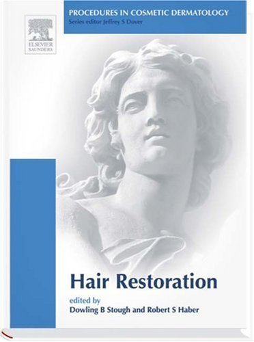 Hair Transplantation. Procedures in Cosmetic Dermatology Series (Procedures in Cosmetic Dermatology) Medicine