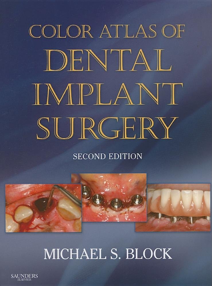 Color Atlas of Dental Implant Surgery Medicine