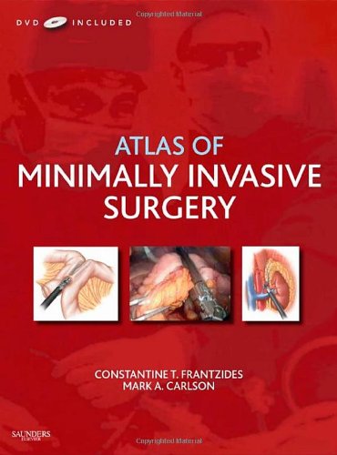 Atlas of Minimally Invasive Surgery, with DVD Medicine