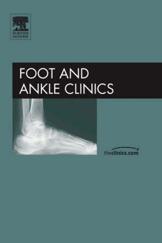 Advances in Posterior Tibial Tendon Insufficiency, an Issue of Foot and Ankle Clinics (The Clinics: Orthopedics) Medicine