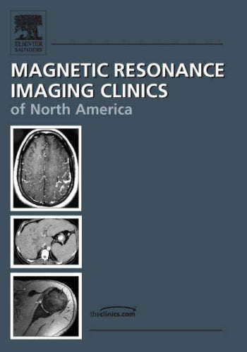 MR Imaging of the Female Pelvis: An Issue of Magnetic Resonance Imaging Clinics (The Clinics: Radiology, Band 14) Medicine