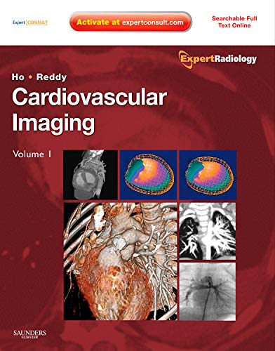 Cardiovascular Imaging, 2 Vols.: Expert Consult: Online and Print (Expert Radiology) Medicine