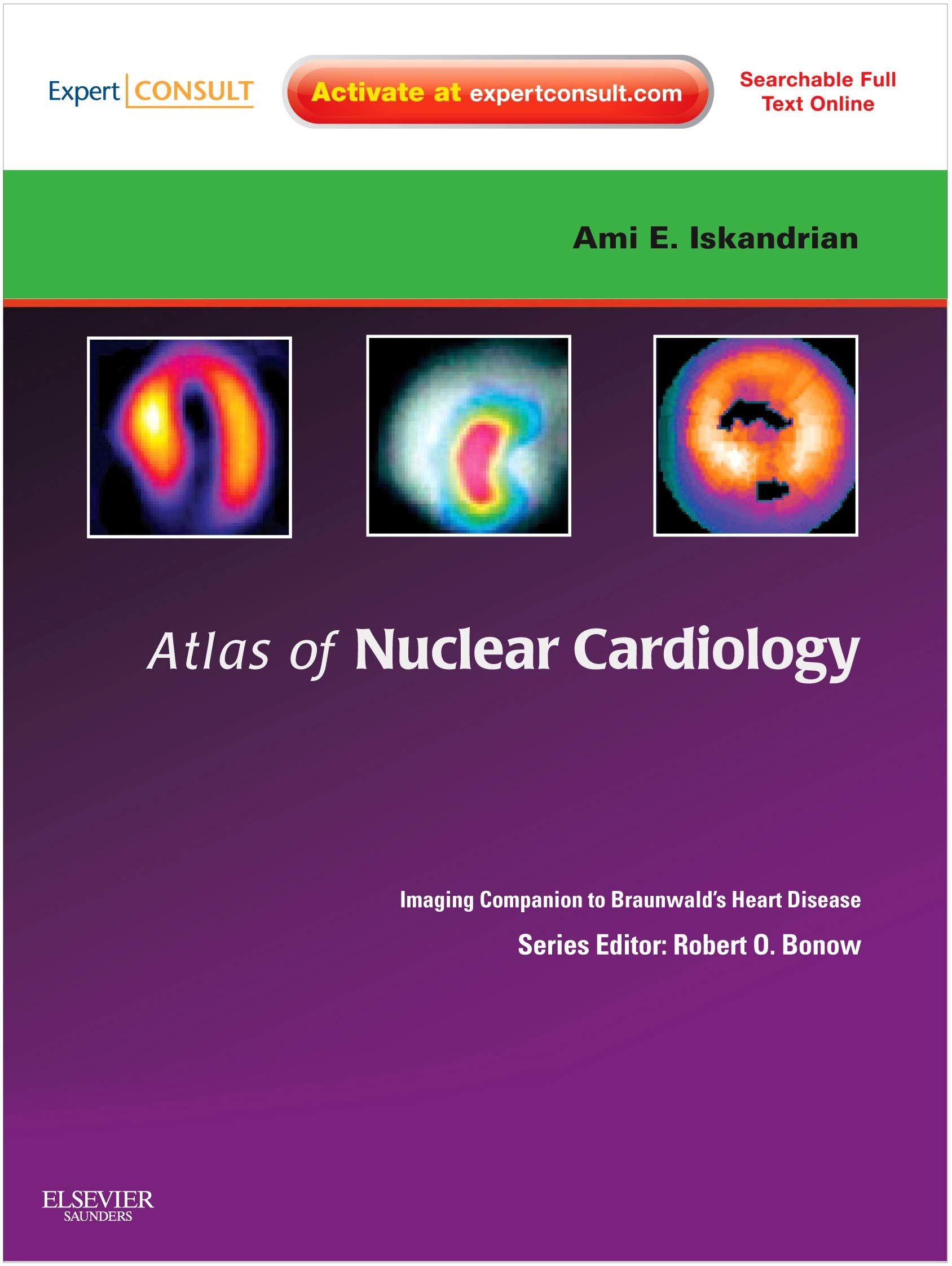 Atlas of Nuclear Cardiology: Imaging Companion to Braunwald's Heart Disease: Expert Consult - Online and Print (Imaging Techniques to Braunwald's Heart Disease) Medicine