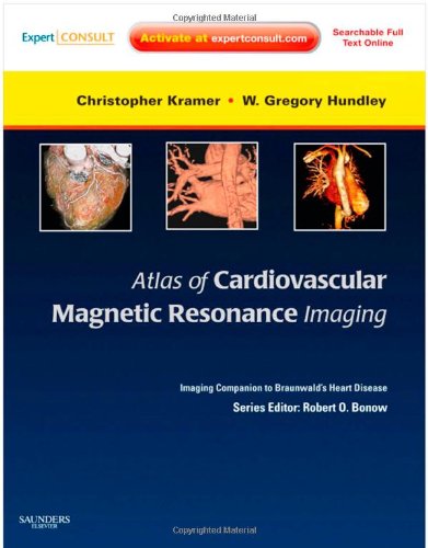 Atlas of Cardiovascular Magnetic Resonance Imaging: An Imaging Companion to Braunwald's Heart Disease. Expert Consult - Online and Print (Imaging Techniques to Braunwald's Heart Disease) Medicine
