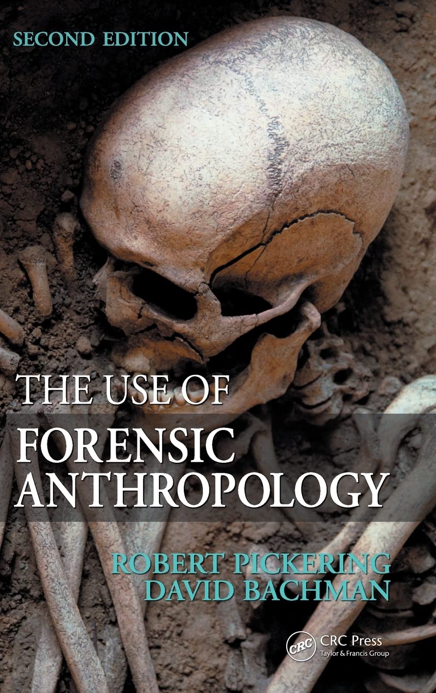 Product Image: The Use of Forensic Anthropology