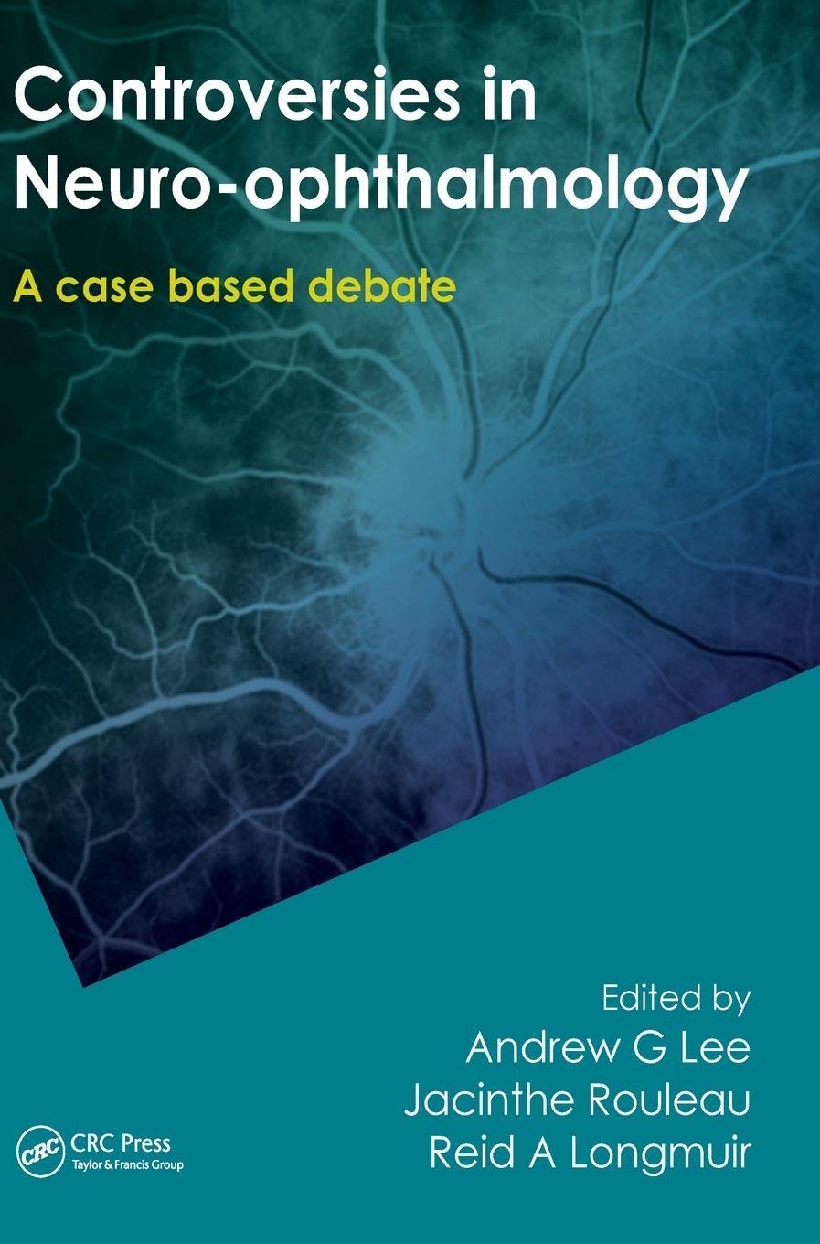 Controversies in Neuro-Ophthalmology Medicine