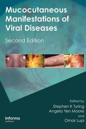 Mucocutaneous Manifestations of Viral Diseases: An Illustrated Guide to Diagnosis and Management Books