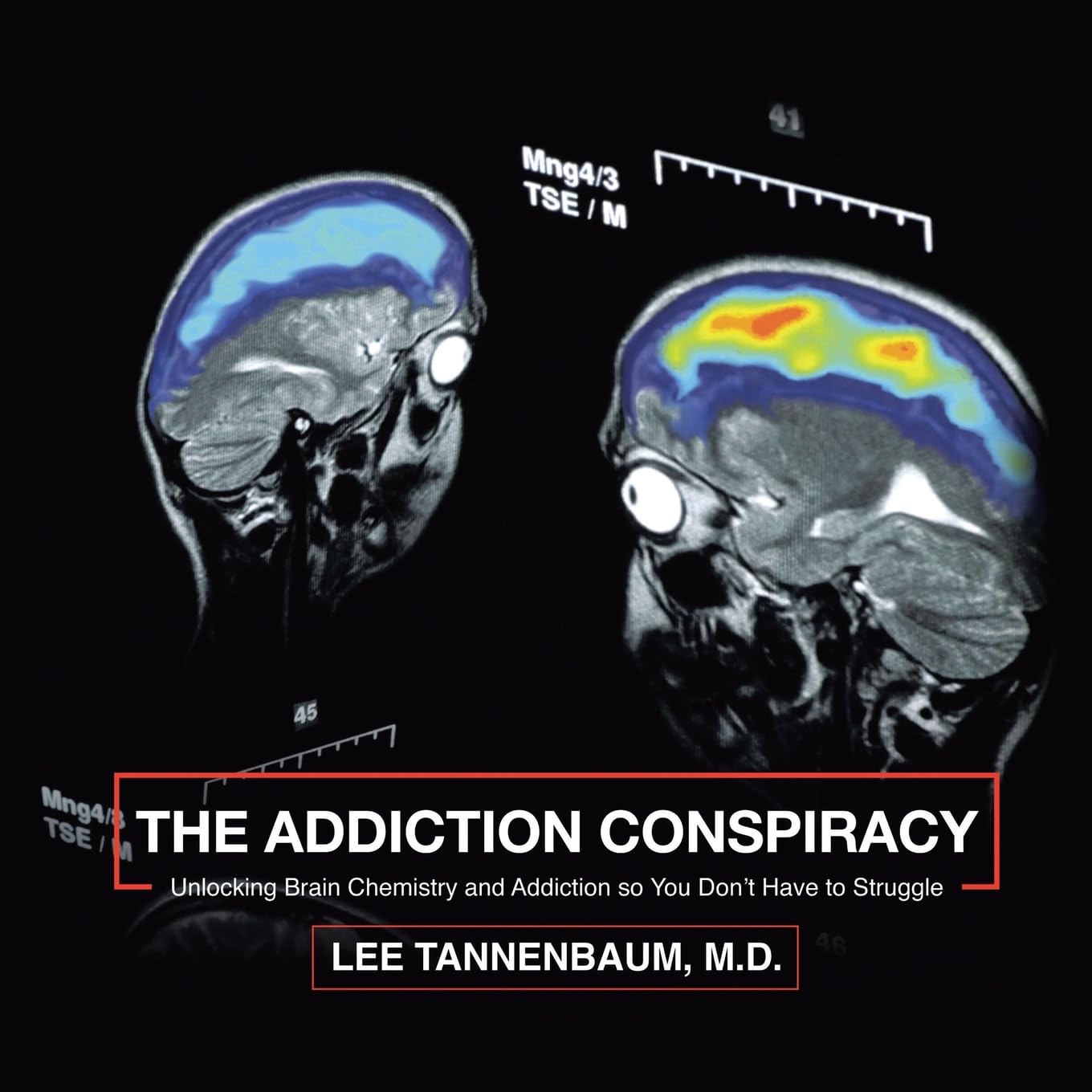 The Addiction Conspiracy: Unlocking Brain Chemistry and Addiction so You Don’t Have to Struggle Medicine