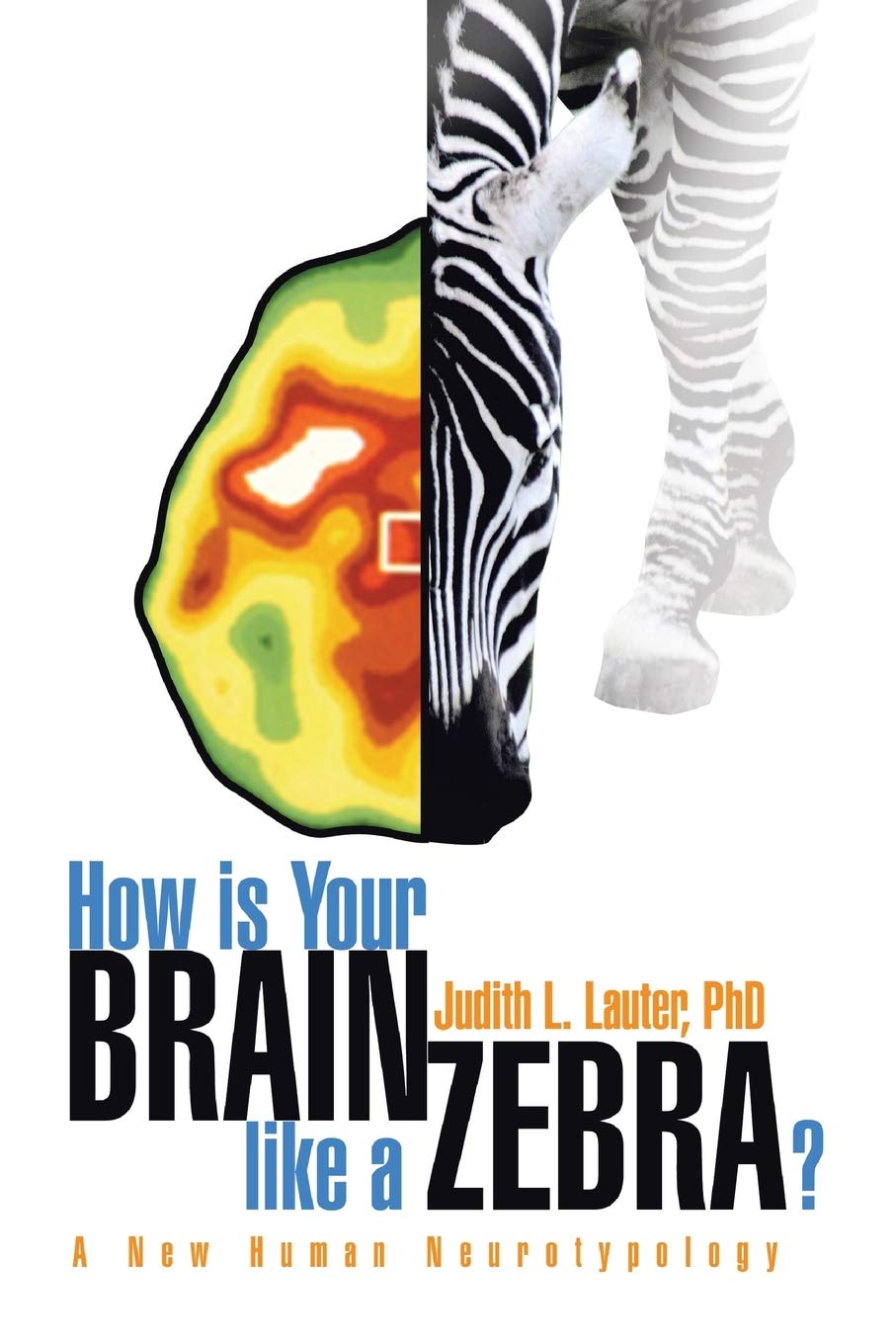 How is Your Brain like a Zebra?: A New Human Neurotypology Medicine