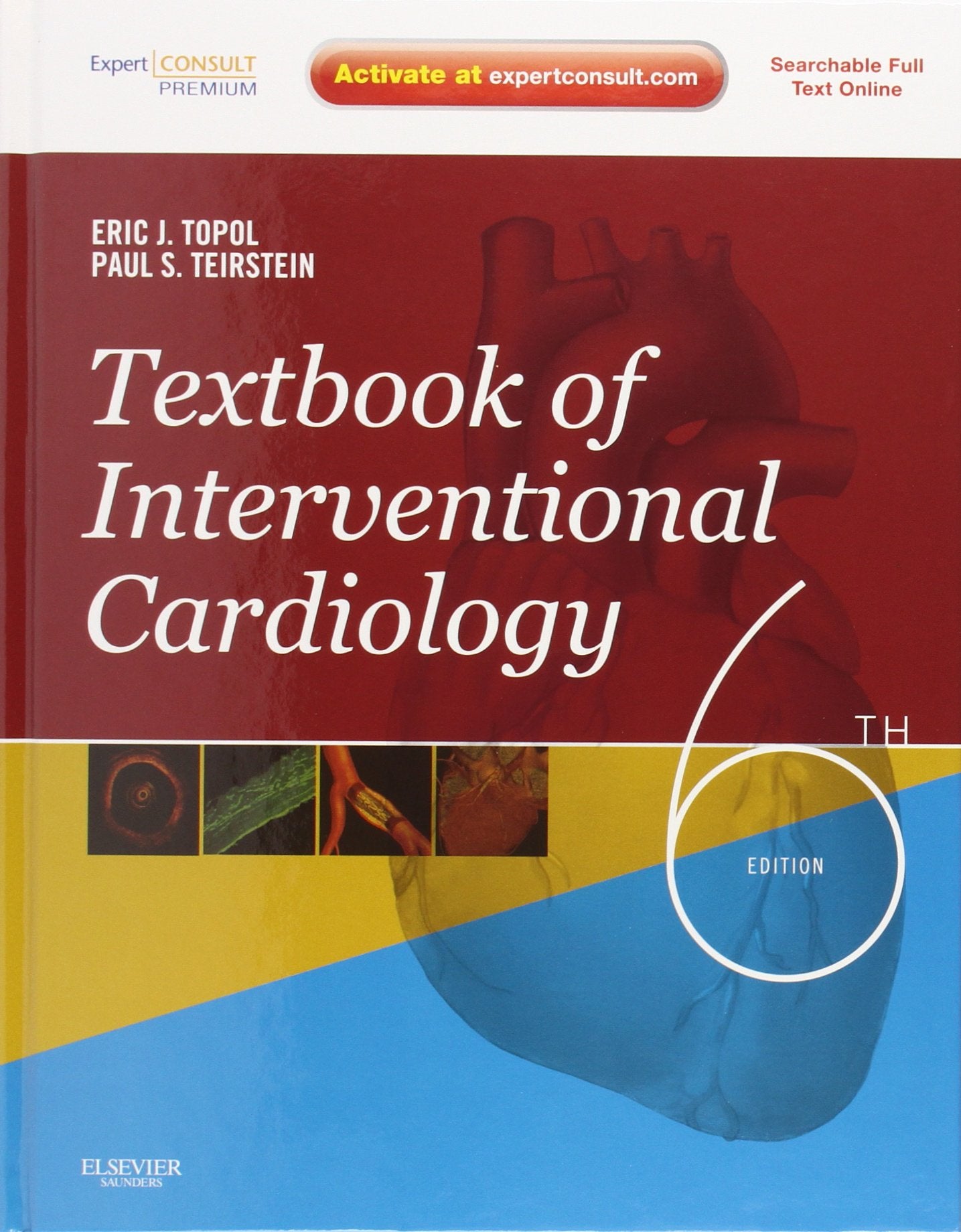 Textbook of Interventional Cardiology: Expert Consult Premium Medicine