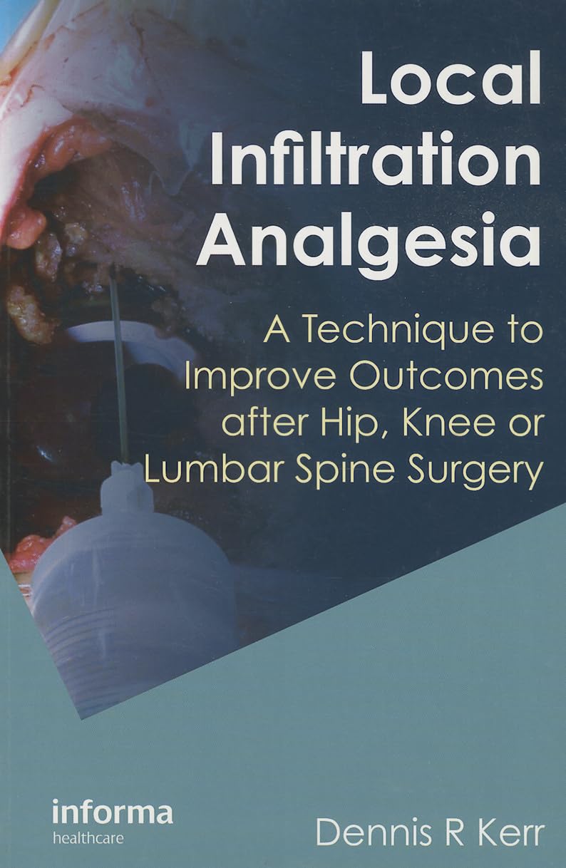 Local Infiltration Analgesia Medicine