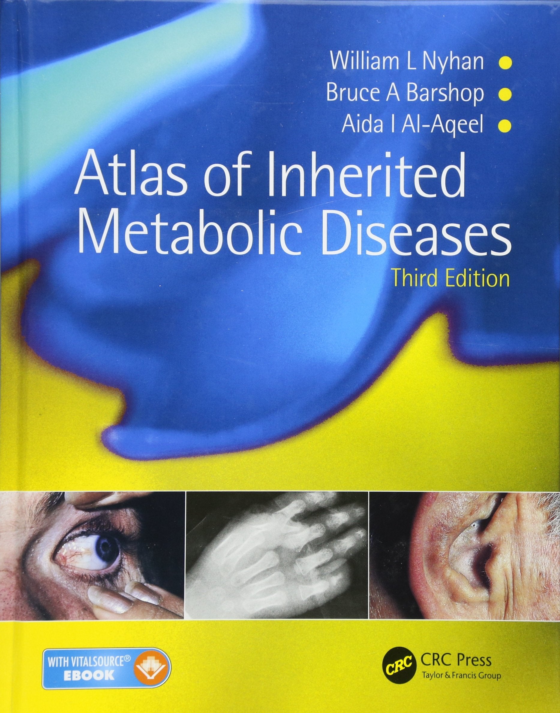Atlas of Inherited Metabolic Diseases book